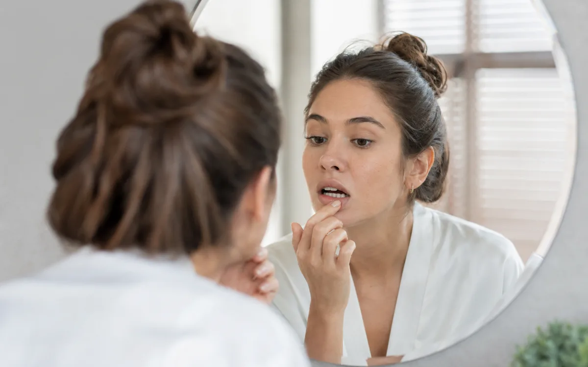 Canker Sores: Prevention, Causes, and Treatment